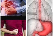 Gastric Pain