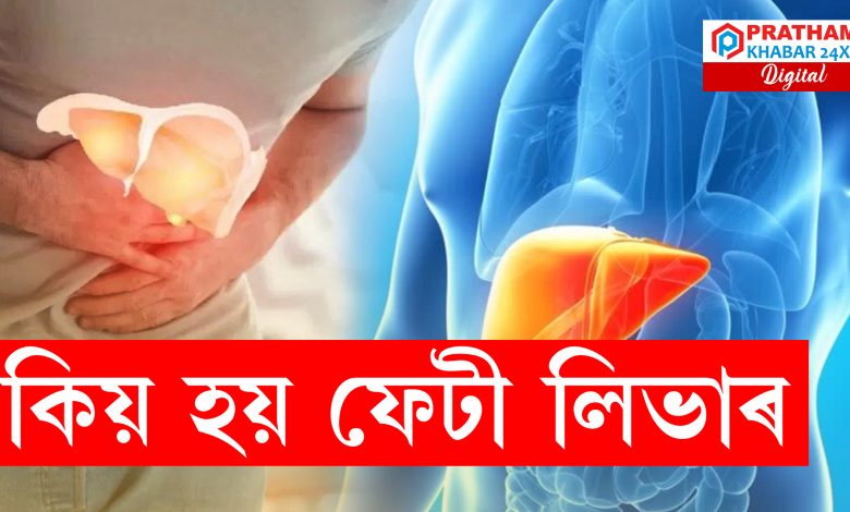 ফেটী লিভাৰ হোৱাৰ কাৰণ কি জানে নে ?